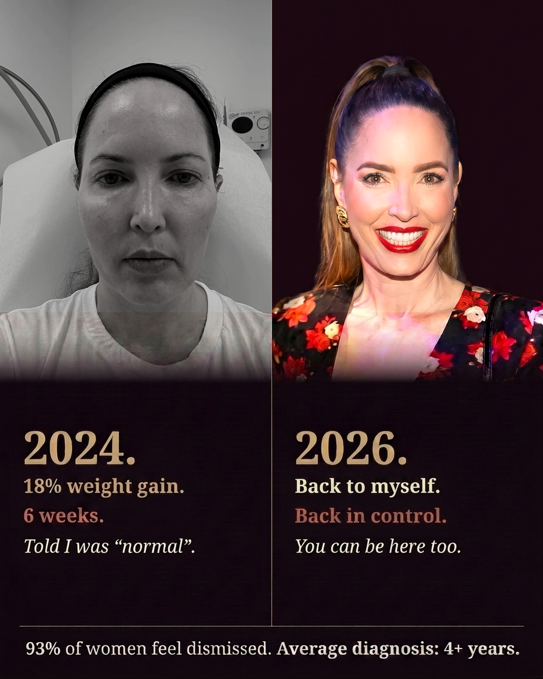 Jennifer G. Bates – 2024 before EHI (18% weight gain, told she was normal) vs 2026 after EHI (back to herself, back in control)